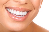 What does your smile say about you? What does your smile say about you?