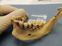 Ancient tooth decay DNA reveals effects of changing diets