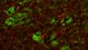 Quercetin