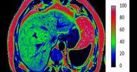 New approach to MRI could slash length of scans