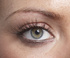 Brow before treatment