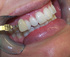 Dental health