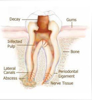 Essential root canal treatment