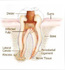 Root Canal Treatment