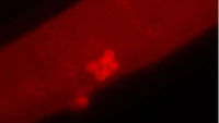 Cause of rare childhood cancer discovered