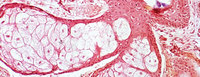 Scientists unlock key to blood vessel formation