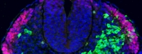 Researchers grow ‘seed’ of spinal cord tissue in a dish