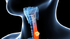 Medical diagram