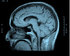 Medical image