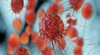 New screening technique could pick up twice as many women with ovarian cancer